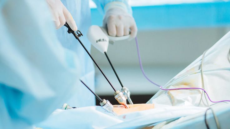 Instruments for PELD System: Application Cases and Benefits