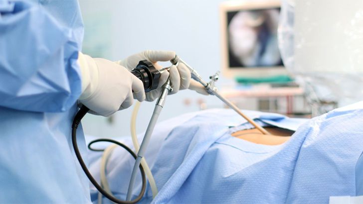 Instruments for PELD System: A Comprehensive Guide